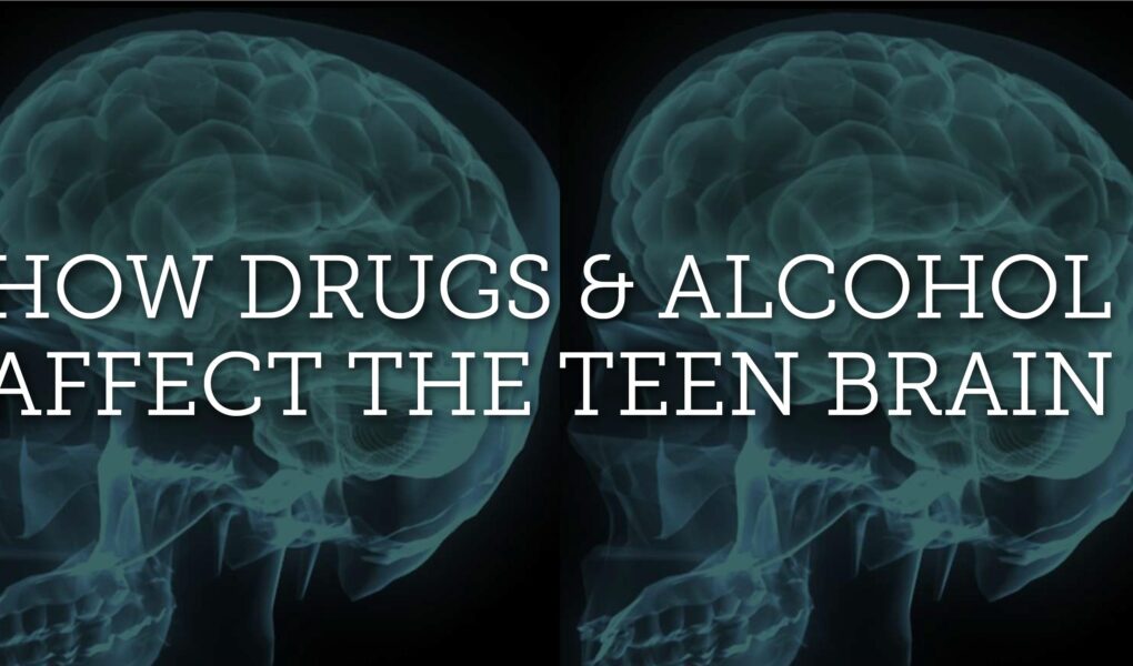 how do drugs affect the brain of a teenager?