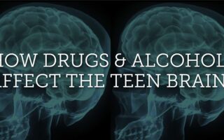 how do drugs affect the brain of a teenager?